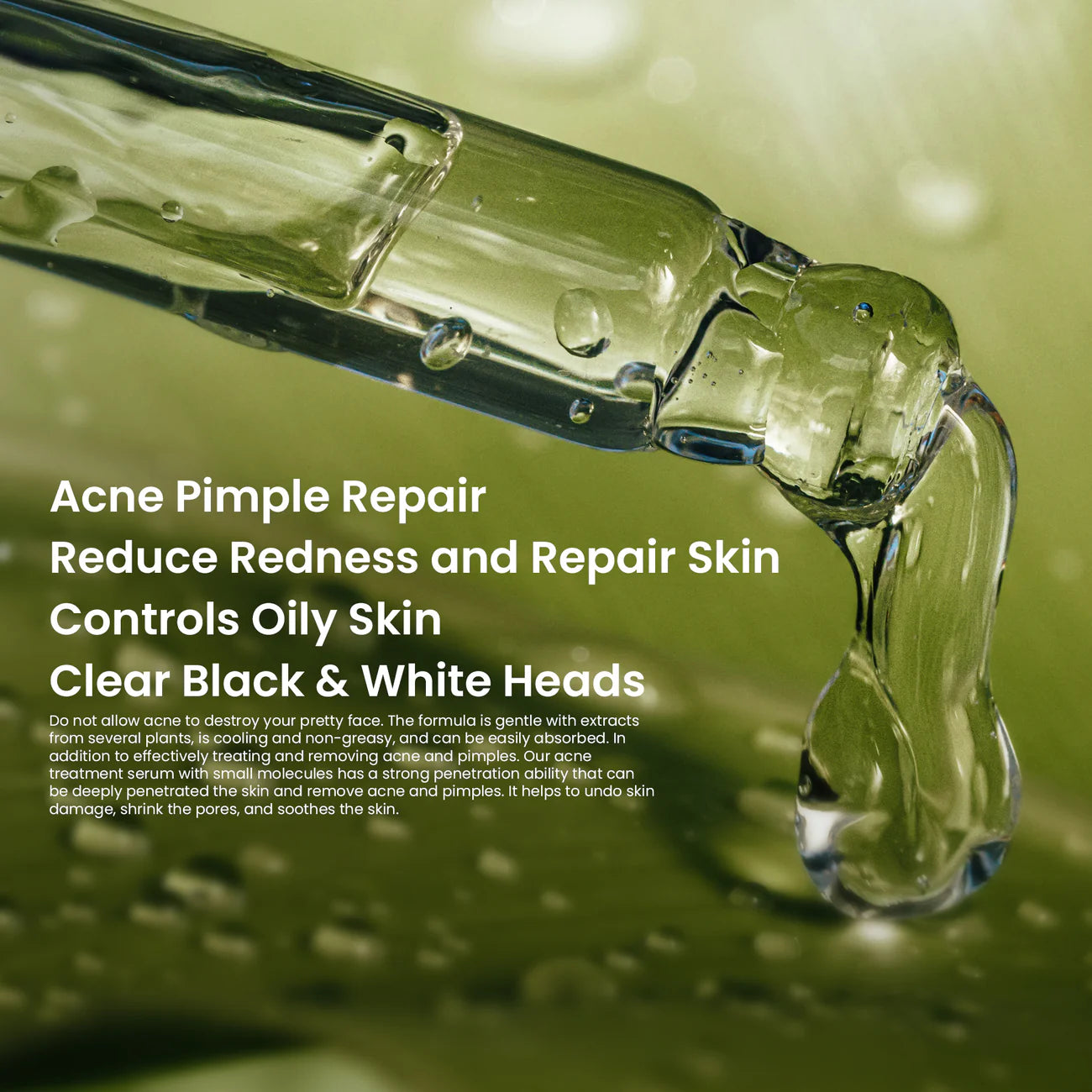 Acne Treatment Face Serum 30ml